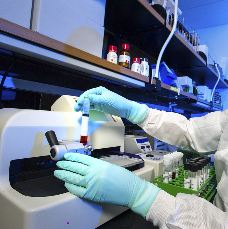 Sewage / Bacteria Testing